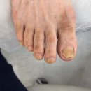 발이야기 | 여주 발관리 방문 후기 [푸스케어 여주오학점] 어머니 모시고 다녀온 이야기