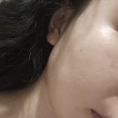 리뉴에트에스테틱(Renuat Aesthetic) | 평택] 고덕 피부관리 리뉴에트 에스테틱 | 등수기관리...소 관리 후기 | 평택신부관리 수기관리샵 추천