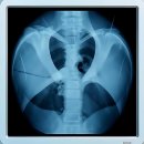 베스트항맥외과의원 | 내 허리가 나갔다! 수원 정형외과 찐텐 후기