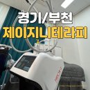제이시스템 | 부천피부관리 옥길동 제이지니테라피 내돈내산 모공세척 이중턱 티리온 효과 후기