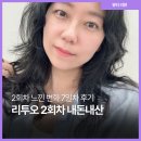 금오산로(대3-7) | 대구리투오 2회 받고 느낀 변화 7일차 리얼 후기
