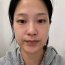 아누보스킨 이미지