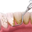 동구이편한치과의원 이미지