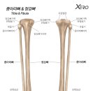 팔뼈(노뼈와 자뼈) vs 다리뼈(정강이뼈와 종아리뼈) 이미지