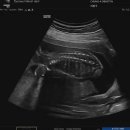 청아여성의원 이미지