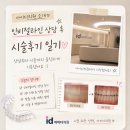 윤학영치과의원 | 아이디치과 인비절라인 성지 다녀왔어요! (가는 방법, 단점, 비용 공유)