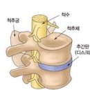 등이 아픈이유 아파요 아플때 알아봐요 이미지