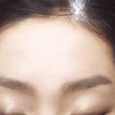 탈모퀸 이미지