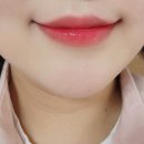덴트천재 이미지