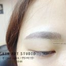 썬스킨
