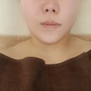 예뻐지는곳 | 송도 비대칭관리 잘하는곳 예뻐지는공간 100% 수기관리 후기