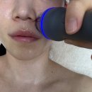 대맥프라자 | [부천 피부관리 위라인] 라라필 물방울 초음파 관리 후기