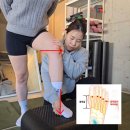 오다리 운동으로 교정이 되나요?(윤아 오다리 교정운동)
