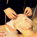 피부과 청담주앤] 플로라셀 결과가 맘에 들어, 플로라셀 두 번째 시술 받고 왔어요.(플로라셀 1~ 2회 후기)