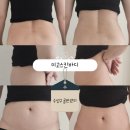 미고 테라피 이미지