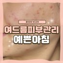 경기도 수원시 영통구 매탄로 매탄로79번길 | 수원여드름관리찐추천 [ 매탄동피부관리 예쁜아침 ] 에서 응급진정트러블관리 받았어요 ( 후기대박 )