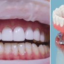 이상치과기공소 이미지