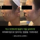 이지수 피부관리실 | 파워 트리 임상 후기, 홈커밍데이, 파워 윤곽 케어...관리, 세이 스파, 대전피부관리실, 문화동 피부관리실
