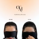 에스엠안전컨설팅 | 대구두피문신 부작용 걱정 없는 1:1 맞춤 시술 달서구두피문신 온미SMP대구