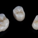 수원탑플란트치과의원 이미지