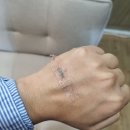어깨 담 걸려서 평택체형교정원 다녀온 후기