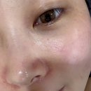 점찍다 | 안양 인덕원 피부관리 마이크로젯으로 모공, 홍조 케어 후기 &#34;마음에 점을 찍다&#34;