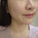 바른약국 | 약국화장품 추천ll약사추천크림 어드밴스드 PDRN 재생크림 후기