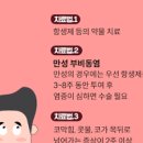 만성 부비동염 원인 이미지