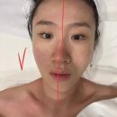 골드스파 | 송도에스테틱 윤곽관리 아로마 백토침 목미인골드스파 솔직후기