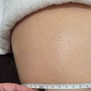 발란스바디메디칼 이미지