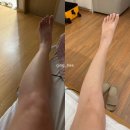 [청라여성병원] 제왕절개 후기 / 청라여성병원 조리원 올라가는 날