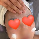 옥계신당로-13 | 구미 옥계 에스테틱 가꿈 피부관리 베이직케어 후기