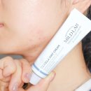 마일드짐 | 올리브영 여드름 센텔라스카 연고 마일드랩 2.0 리뉴얼 트러블 진정 후기