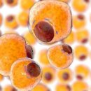 오름메디 이미지