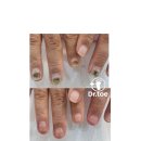 미소지앤의원 | 구미 내성발톱 관리 찐 후기!｜닥터토 방문 케어와 요양원 봉사 이야기