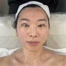호매실 피부관리 찐후기💆‍♀️ 뱀부테라피로 등관리+윤곽관리까지!