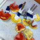 하이교정치과기공소 이미지