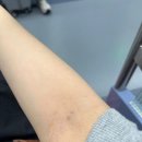 일층약국 | 25w / 서울이대 임당검사 그리고 재검 •• 통과 후기