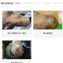 구본교의수족연구센터 | #구본교의수족연구센터 구본교신기술의지연구소 의족 의족의달인 구본교카본의족 인공지능무릎 통증치료...