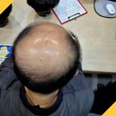 미예뜰 | 미예뜰 맞춤가발에서 완벽한 가발을 찾은 이야기를 들어보세요