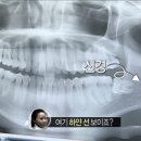 사랑니빠지는구강악안면외과치과의원 이미지