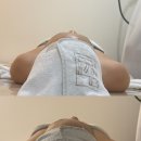 비엠케이 | 강남에스테틱 꽁쌤에스테틱 라운드숄더 교정 RSPT 솔직후기