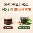 해동한방병원 | 피부건선치료 건선연고 정선건선 고민 끝낸 리얼 후기