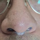 메디케어 구로점 | 비강확장기 코막힘 해결될까? 환절기 비강 관리 필수템 닥터코링