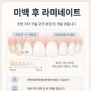 보일치과기공 네이버블로그