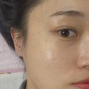 포항 문덕 피부관리실 &#39;김지효피부연구소&#39; 수분관리 후기(feat.깐달걀 물광피부)