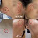 교방동102 | 창원 마산 교방동 흑자 관리 수앤유뷰티 재방문후기