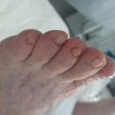 의정부 무좀 꼼꼼하게 관리해준 레푸스 앤 두두뷰티