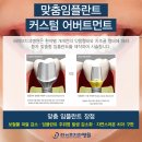 라이브치과기공소 이미지
