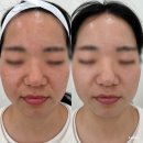 <카린뷰티랩> 제주 화북 제주피부관리 제주에스테틱 신부관리 스칼프에어 속눈썹펌 추천샵 방문후기
